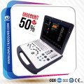 La mejor máquina portátil del ultrasonido del color DW-C60 para el escáner del ultrasonido del doppler del color 3d